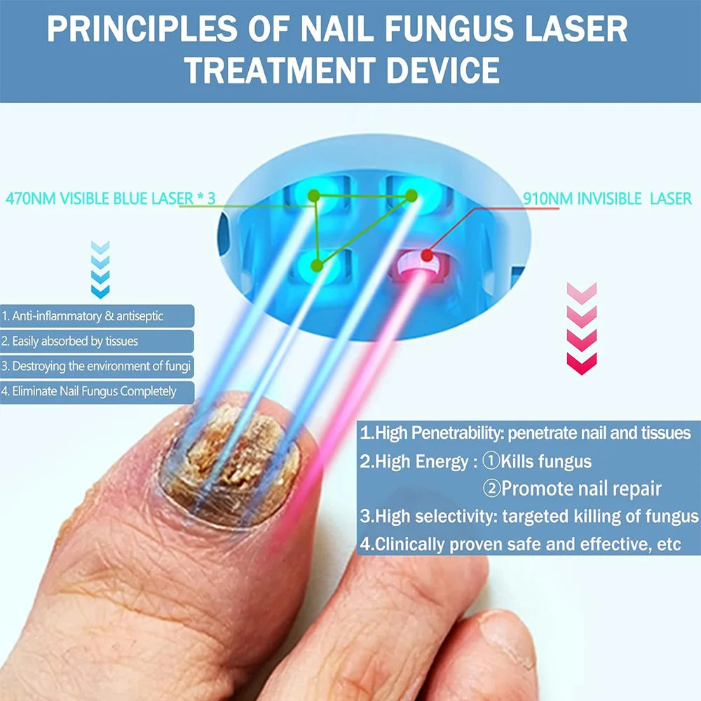 Nail Fungus Treatment Tools Fungal Nail Treatment Anti-Equipment Effectively Remove Fungal Toenail Nail Fungal Infection