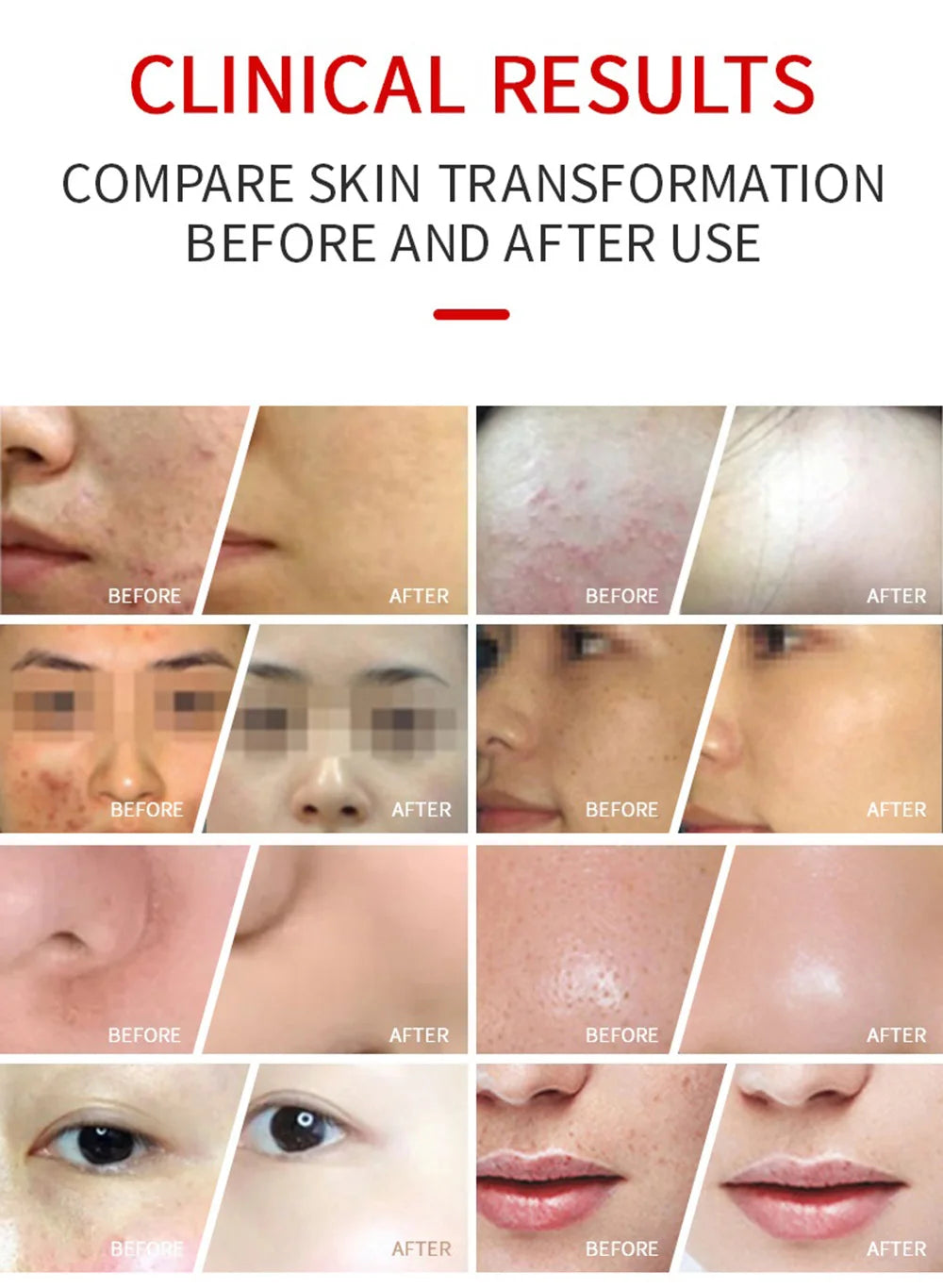 7 Colors LED Face Mask PDT Equipment SPA Facial Spray Device Skin Rejuvenation Light Facial Body Beauty Machines For Skin Care