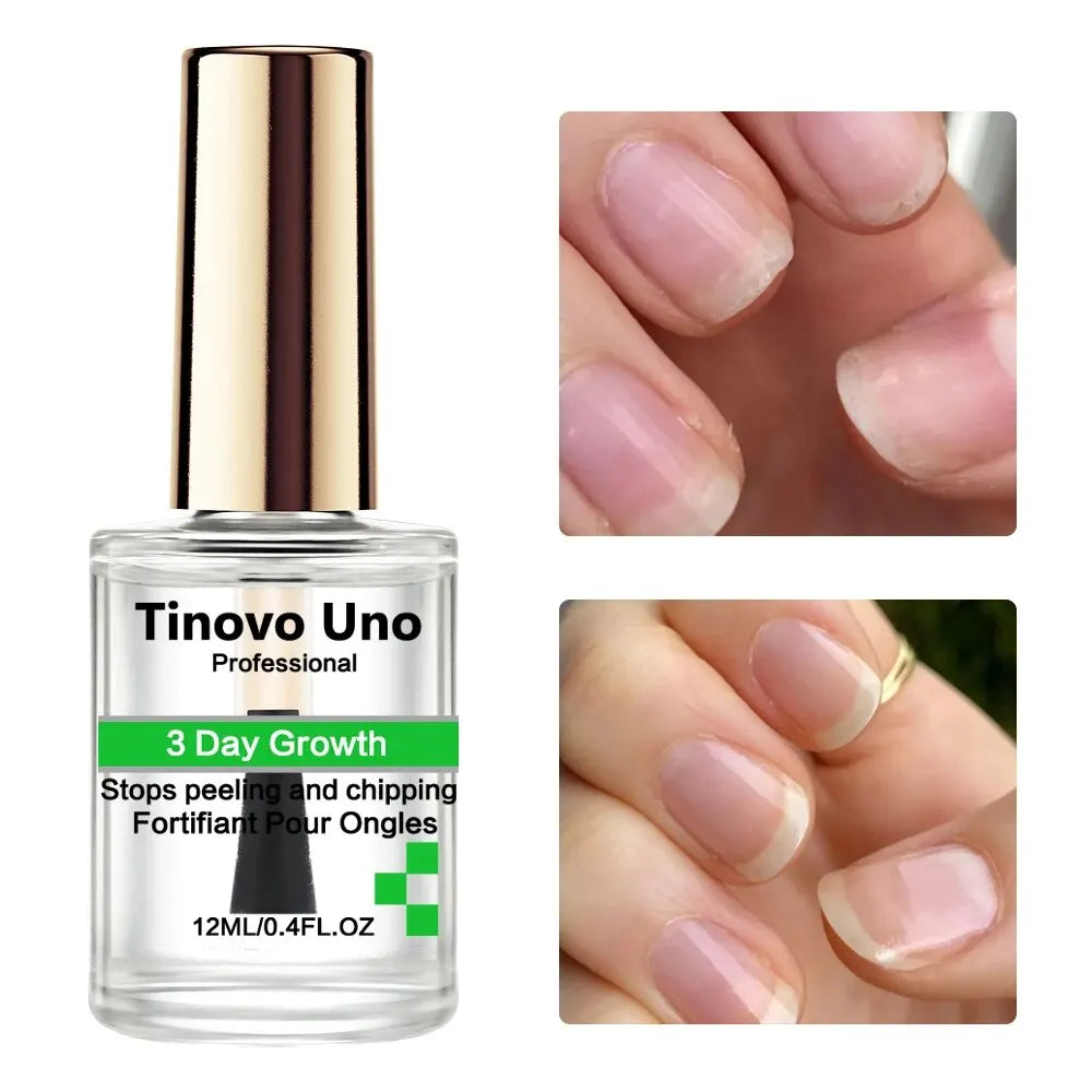 Tinovo Uno 3 Day Nail Growth Treatment Fast Keratin Nail Hardener Strengthener for Repair Brittle Thin Nails Manicure Care Tools