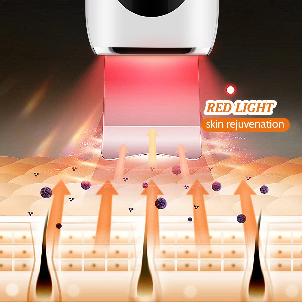 Ultrasonic Face Skin Scrubber Vibration Nose Deep Cleaning Machine   Facial Spatula Blackhead Remover Peeling Shovel Pore Clean