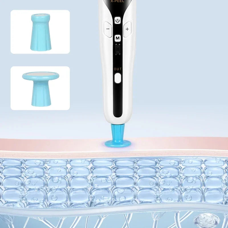 Professional 2 in 1 Plasma Pen Ozone Anti Acne Pen Sterilize Acen Skin Spot Remover Face Lifting Skin Eyelid Lift Mole Removal