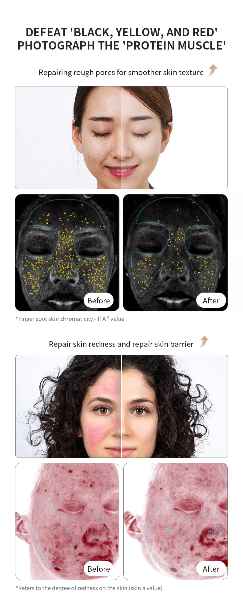 LED Facial Mask Red Light Therapy Photon Anti-Acne Wrinkle Removal Skin Rejuvenation Whitening Spa Mask Face Beauty Devices