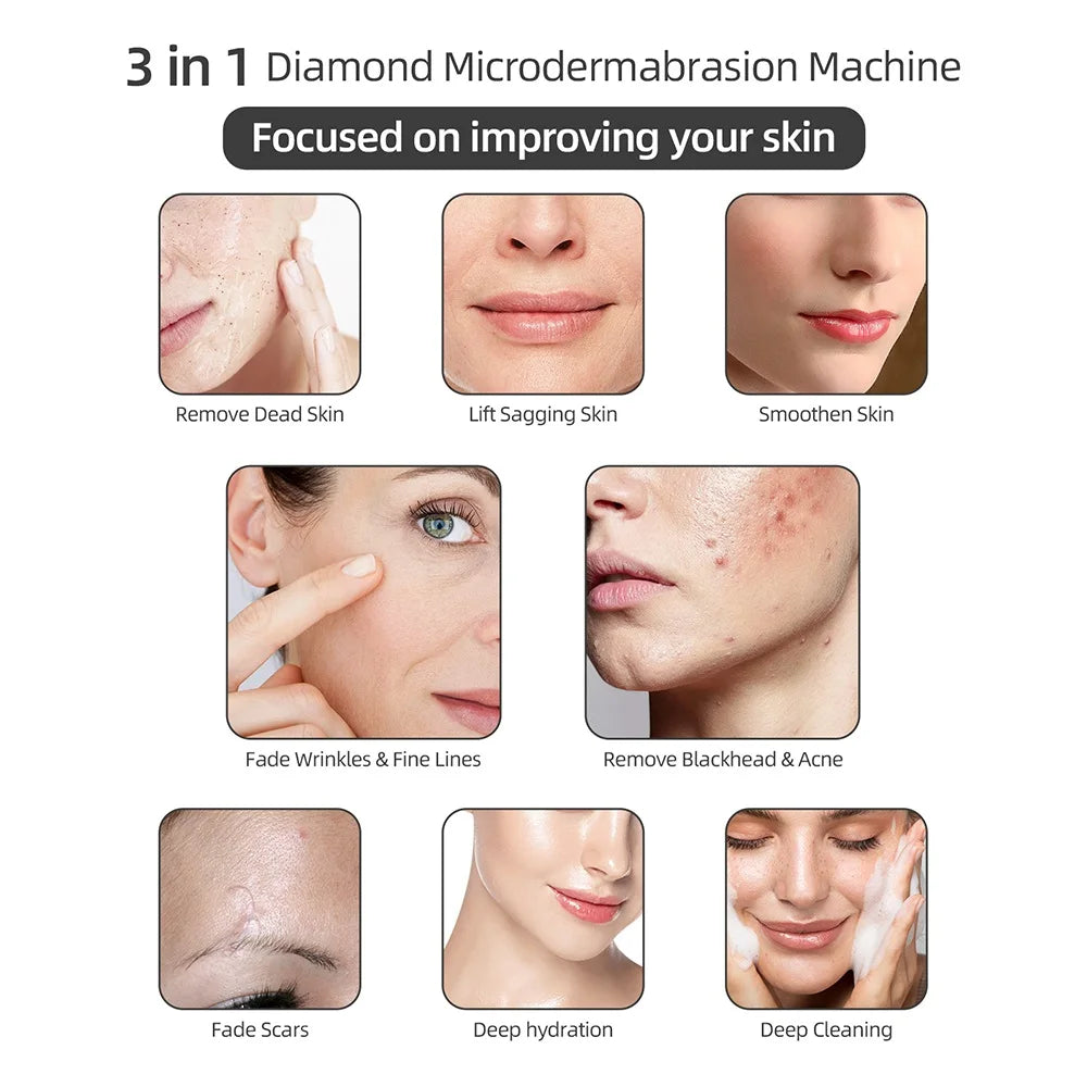 Home Use Facial Diamond Microdermabrasion Machine Face Peeling Beauty Machine Skin Exfoliation Pore Deep Cleaning SPA Skin Care