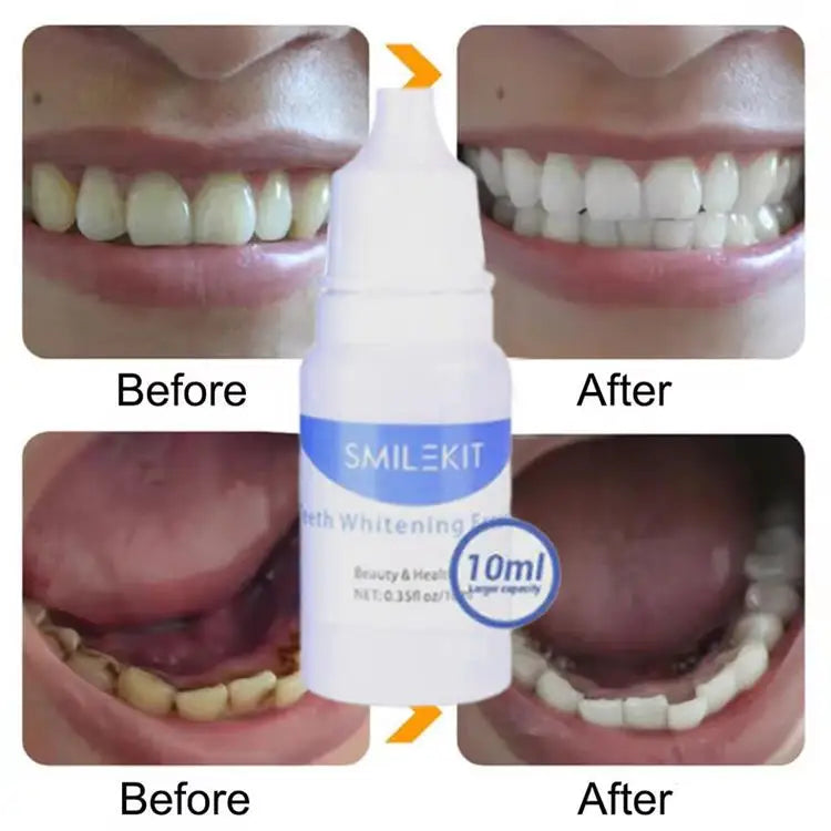 Teeth Whitening Essence Powder Clean Oral Hygiene Whiten Teeth Remove Plaque Stains Fresh Breath Oral Hygiene Dental Tools Set
