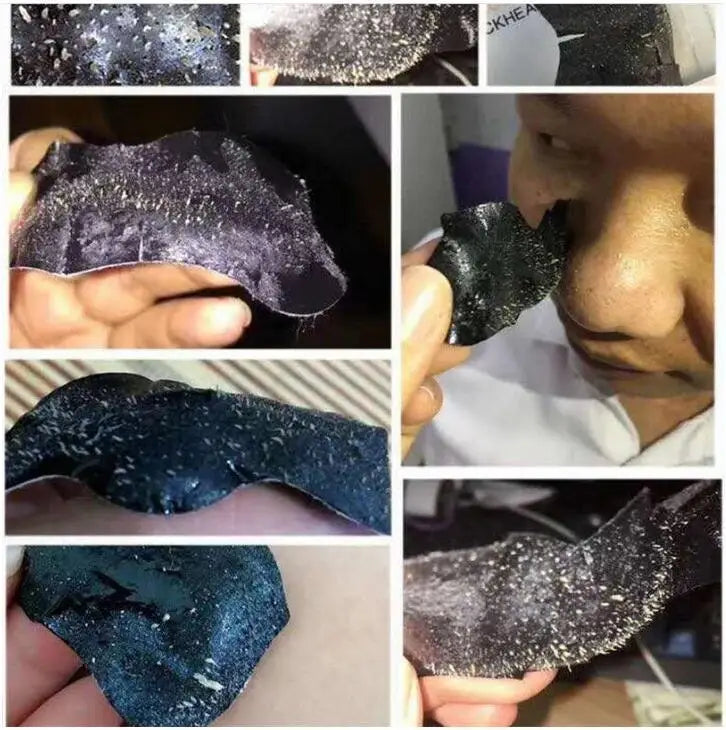 10PCs Bamboo Charcoal Tearing Nasal Mask Paste Can Quickly Remove Blackheads and Comedones and Restore a Refreshing Nose