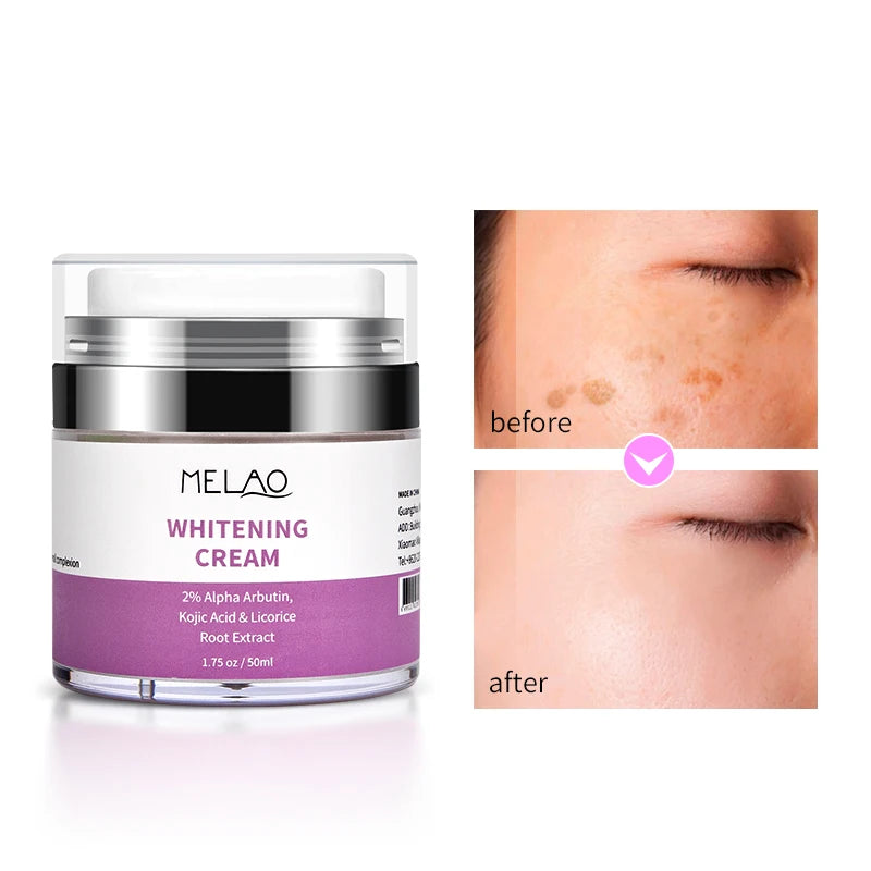 MELAO Whitening Cream Dark Skin Cream Moisturizing Brighten Face Underarm Armpit Knee Body Lotion