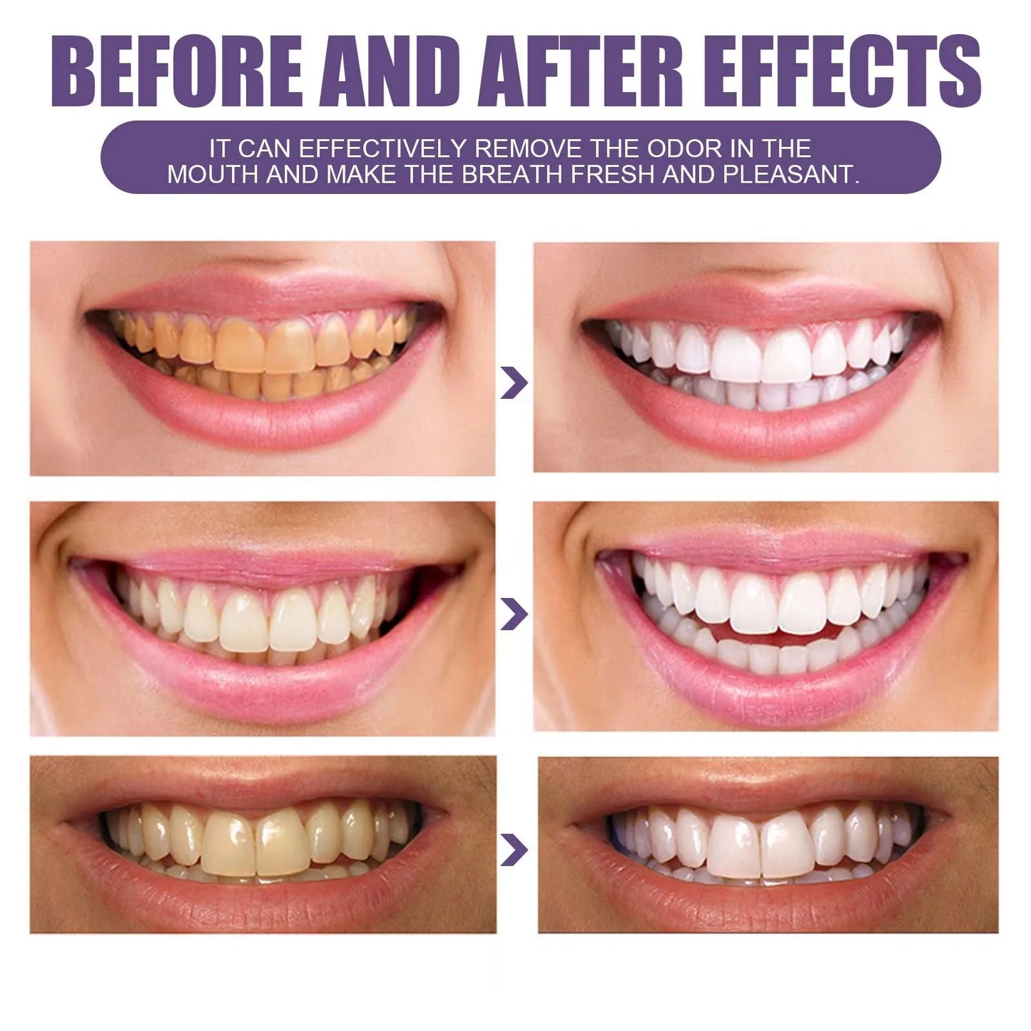Teeth Whitening Powder Has A Whitening Effect, Which Is Effective For Deep Stains Tooth Whitening Care Product Healthy Gifts