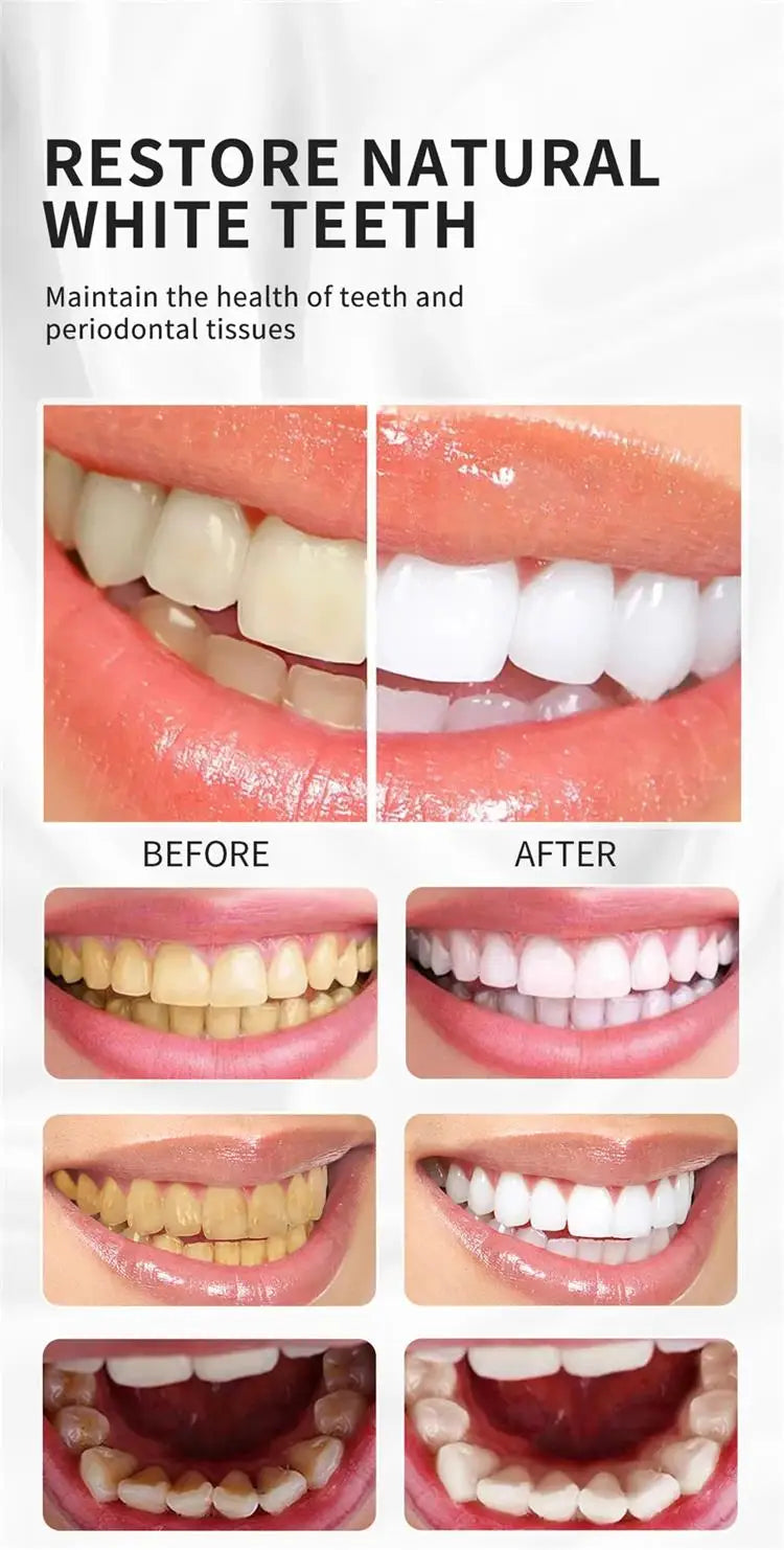 Teeth Whitening Essence Powder Clean Oral Hygiene Whiten Teeth Remove Plaque Stains Fresh Breath Oral Hygiene Dental Tools Set
