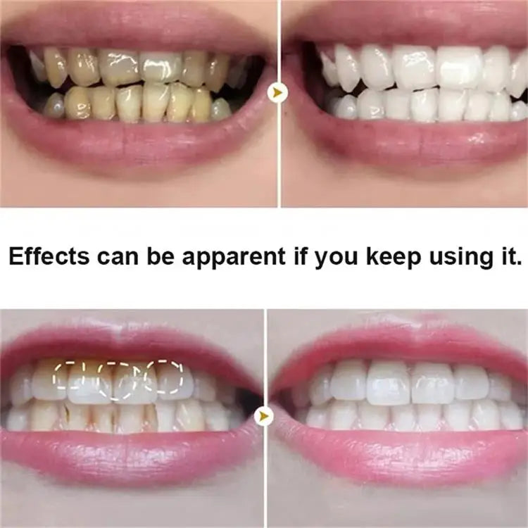 Teeth Whitening Essence Powder Clean Oral Hygiene Whiten Teeth Remove Plaque Stains Fresh Breath Oral Hygiene Dental Tools Set