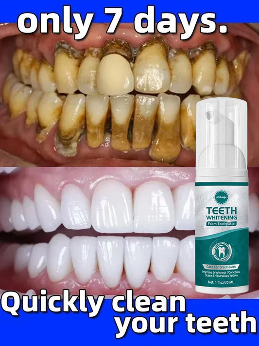 remover dental calculus whitening teeth mouth odor removal bad breath Preventing Periodontitis