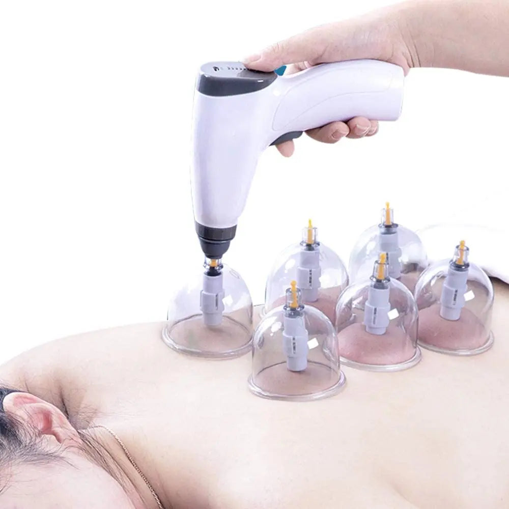 Chinese Medicine Suction Cups Anti Cellulite Electric Bank Vacuum Hijama Cupping Glasses Therapy Physiotherapy Massage Body Jars