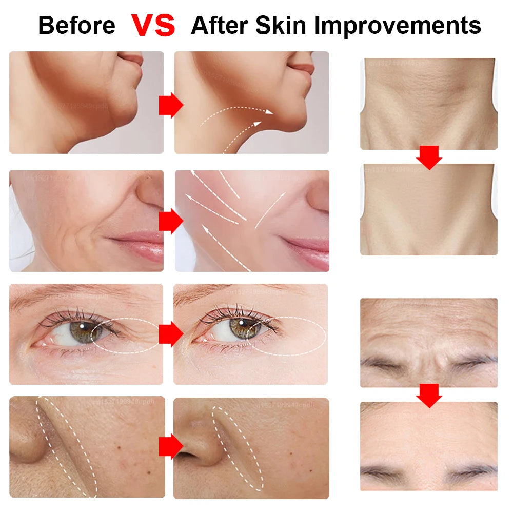 HIFU Face Lifting Facial Massager Mini HIFU Face Lifting Machine Facial Microcurrent Skin Rejuvenation Anti-aging Face Massager