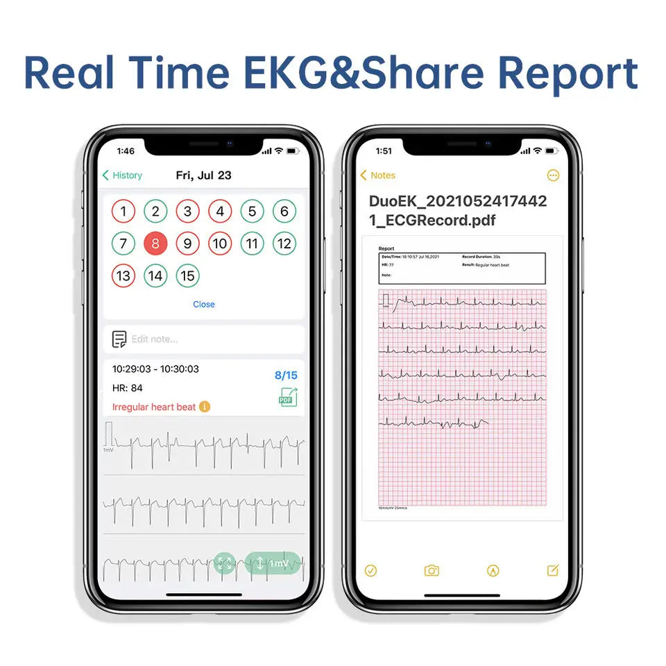 Pocket ECG Monitoring Device with OLED Screen Bluetooth EKG Monitor for Rhythm Waveform, Free APP AI Analyze with iOS/Android