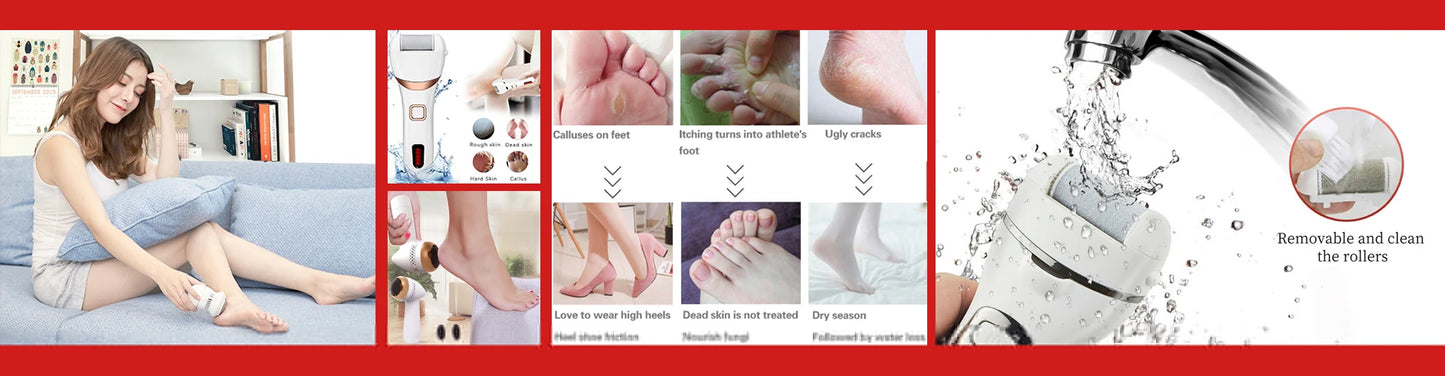Stainless Steel Foot Callus Shaver Heel Hard Skin Remover Hand Feet Pedicure Razor Tool With 10pcs Blades Foot Care Foot File