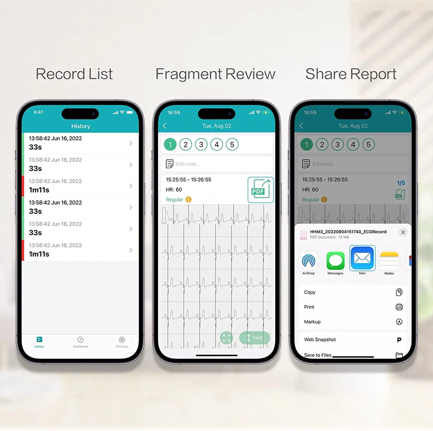 Pocket ECG Monitoring Device with OLED Screen Bluetooth EKG Monitor for Rhythm Waveform, Free APP AI Analyze with iOS/Android