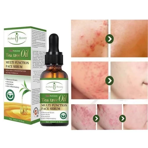 Aichun Beauty Tea Tree Oil Multifunction Face Serum -30ml