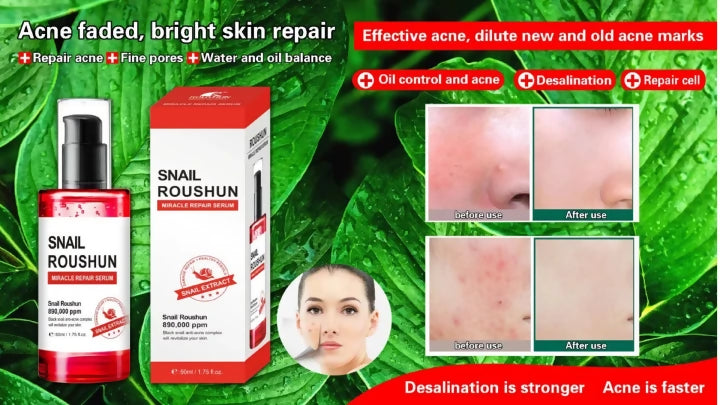 Roushun Miracle Repair Serum Black Snail Extract, Anti-acne