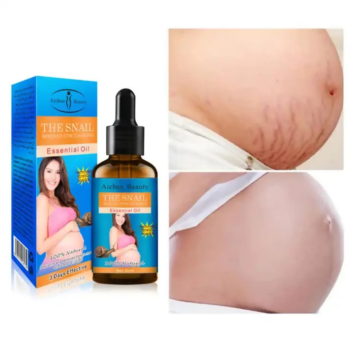 Aichun Beauty-The Snail Removes Stretch Marks Essential Oil-30ml