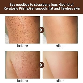 MOOYAM Goodbye To Strawberry Legs Cream