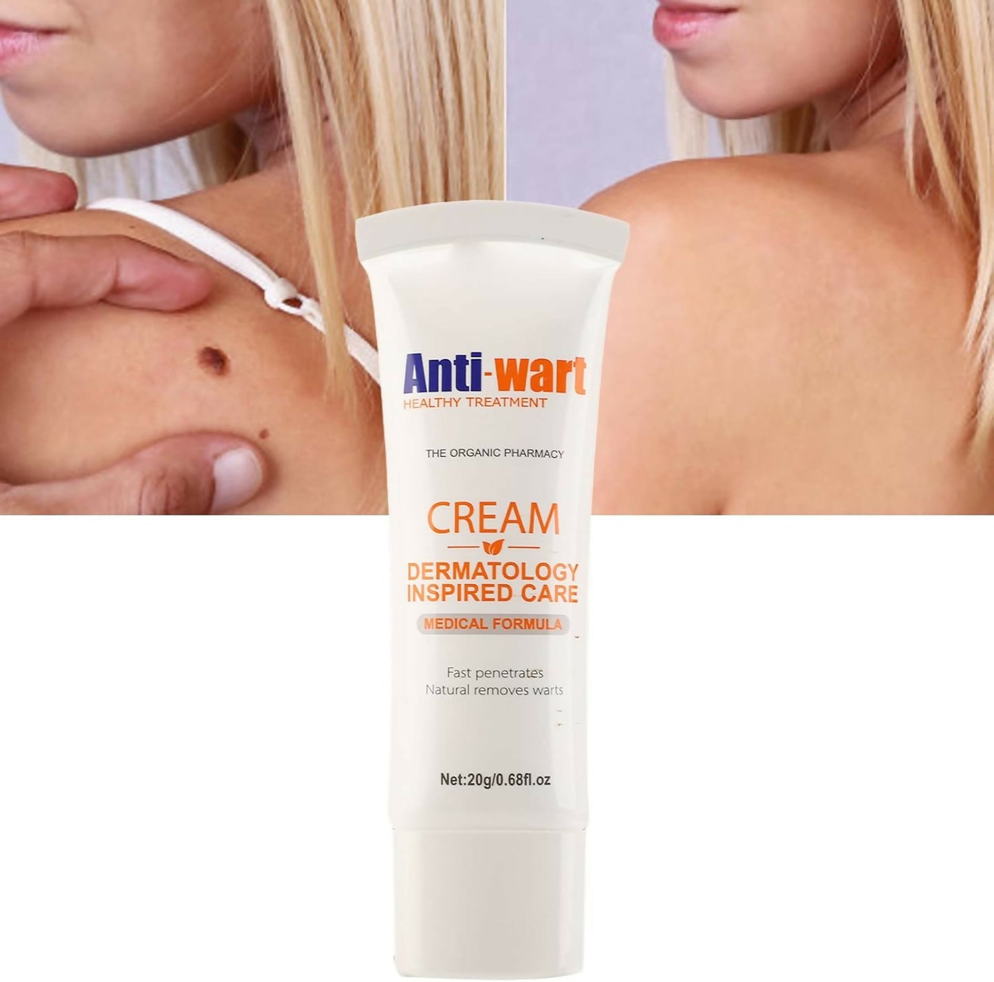 Aichun Beauty Maximum Strength Salicylic Acid Cream