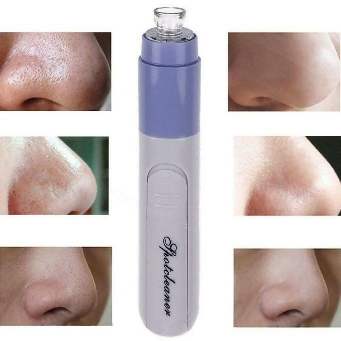 Vacuum Facial Pore Spot Cleaner Acne Remover Nose Blackhead