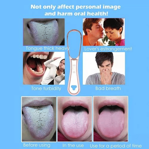 https://img.kilimall.com/c/obs/seller/100008998/goods_image/250731184439_c0eb21ac4aa69e2c299c67222d97e4b8.jpg