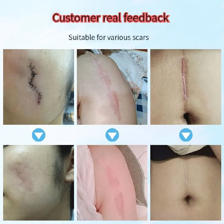 https://img.kilimall.com/c/obs/seller/100009921/goods_image/260122124757_65ef0c13b25b8e5f94454a7a98f802c3.png