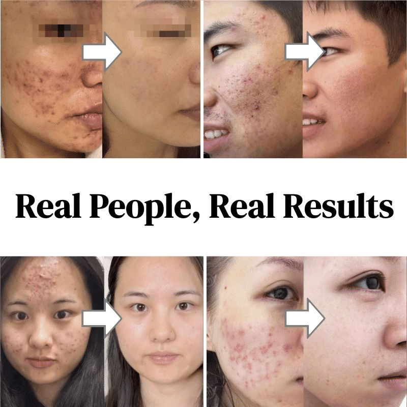 https://img.kilimall.com/c/obs/seller/100011329/goods_image/260407125937_0d3b6734168d5b2b9d373d04967d9050.jpg