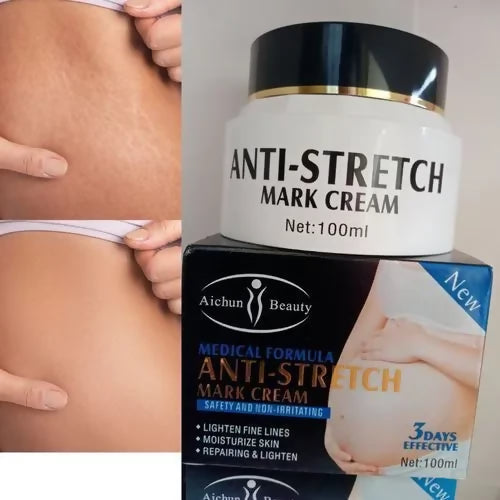 Aichun Beauty Anti- Stretch Marks Cream