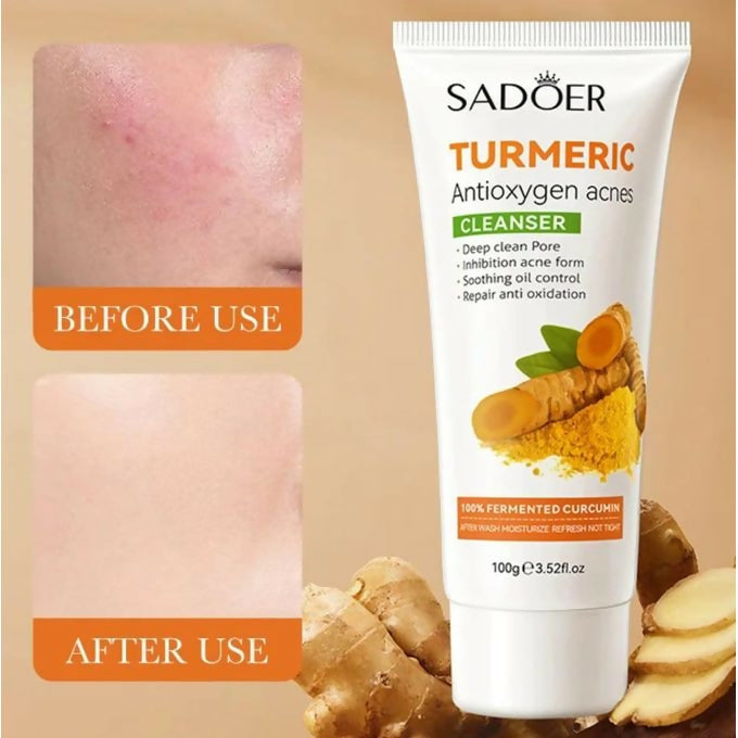 SADOER Turmeric Face Wash Cleanser