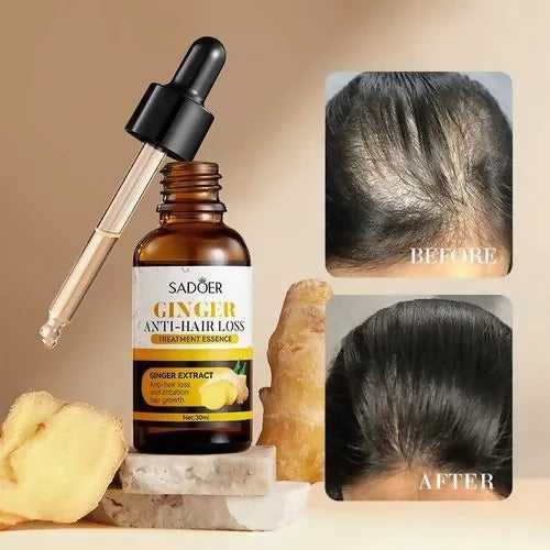 SADOER Ginger Anti Hairloss Treatment Essence, Hair Growth