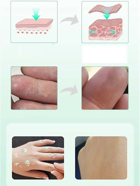 Ingrams Skin Doctor Camphor Cream (Herbal)500g