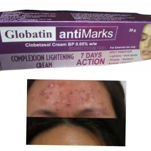 Gandour Globatin Antimarks Cream