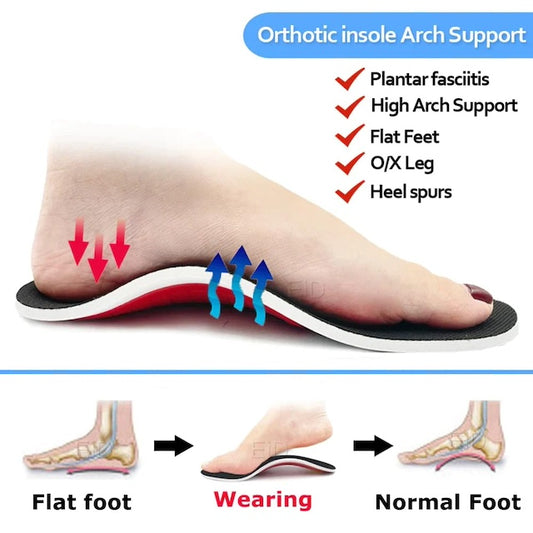 Orthopedic Insoles, OrthoSole Flat Foot Correction, Pain Relief Insoles, Orthopedic Foot pain Arch Support, Insoles for Flat Feet