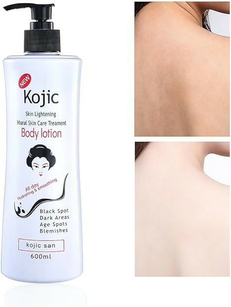 Kojic Skin Lightening Body Lotion