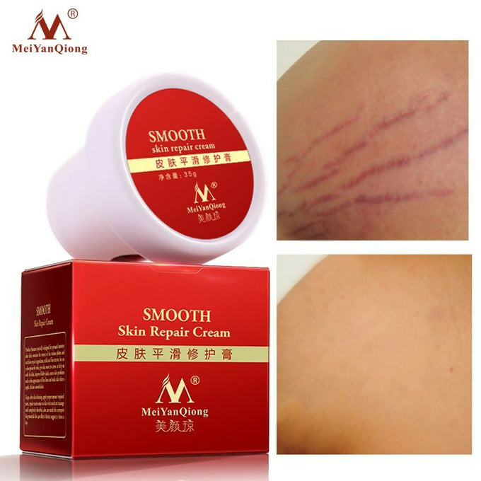 Meiyanqiong Skin Repair Cream