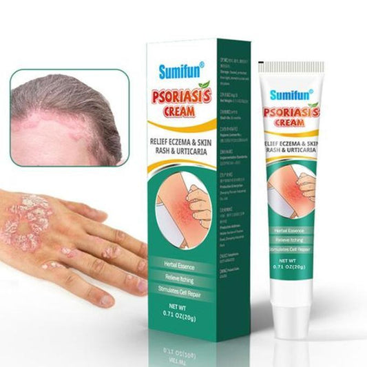 Psoriasis Cream, For Dermatitis, Psoriasis, Shingles, Rash, Eczema