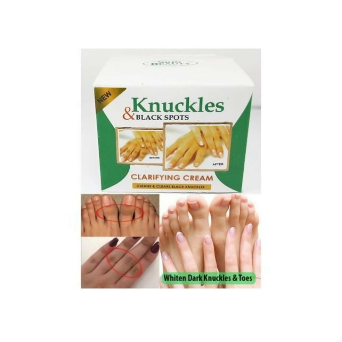 Skin Beauty Knuckles Elbow Knee Toes Black Spot Cream