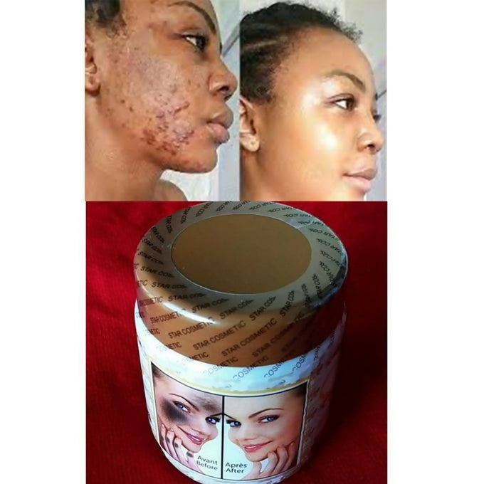 Star Skin Repair Corrector Cream With Argan Oil & Shea Butter