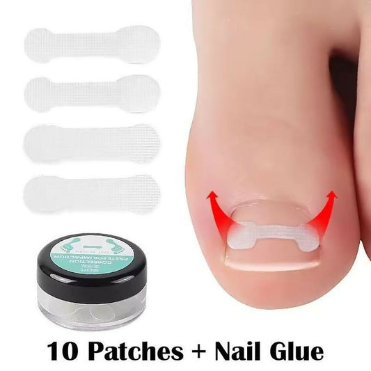 10pcs/box Ingrown Toe Nail Correction Sticker Patches