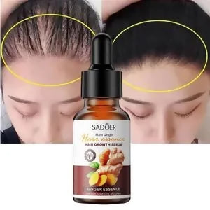 sadoer Anti Hair Loss Serum-30ml